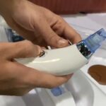Get Clear Skin: Derma Suction Vacuum Blackhead Remover & Pore Cleaner photo review